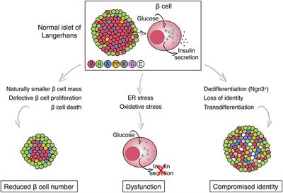 Metabolic Stress and Compromised Identity of Pancreatic Beta Cells